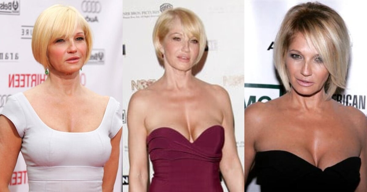 Ellen Barkin Accident