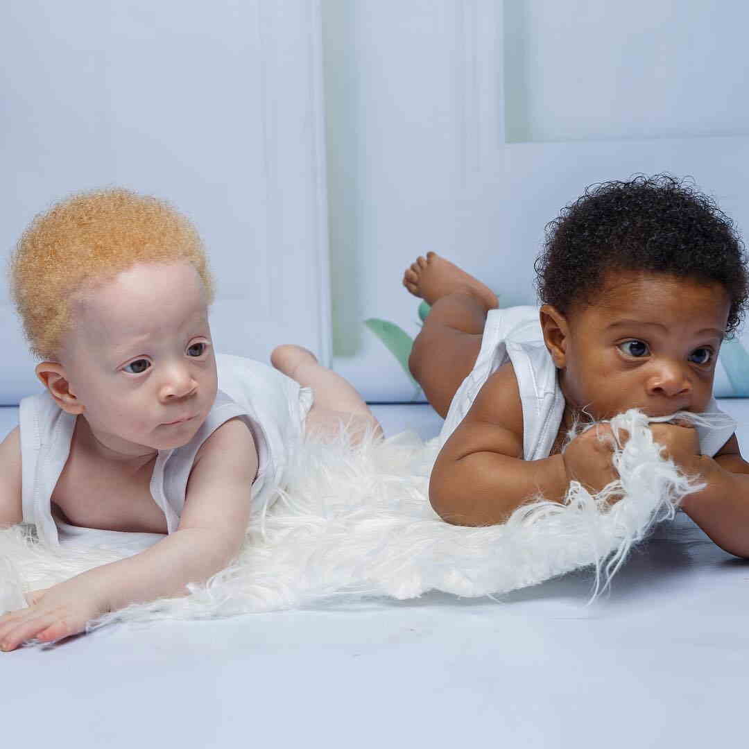 Две черные близняшки. Близняшки с разным цветом кожи. Темнокожий и светлокожий ребенок. Непохожие двойняшки. Темнокожие Близнецы.