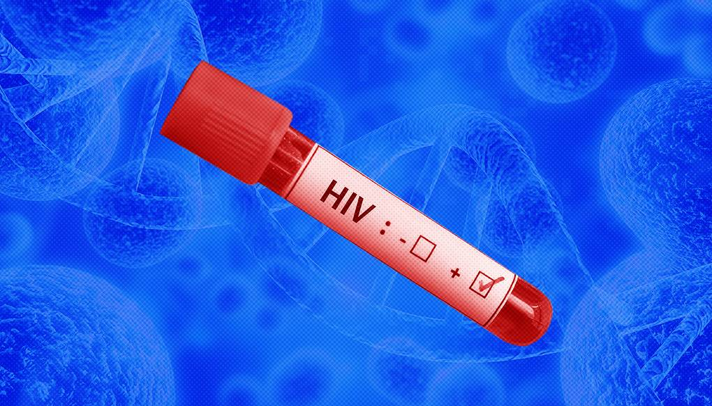 Анализ крови на ВИЧ