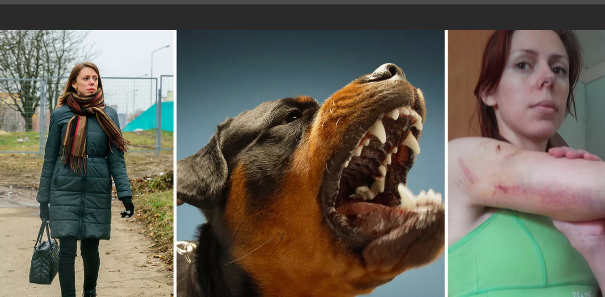 Пострадавшая от нападения собаки женщина