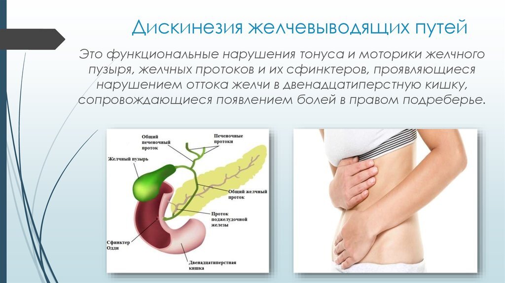 Желчный пузырь где находится и как болит у женщин фото лечение симптомы и лечение