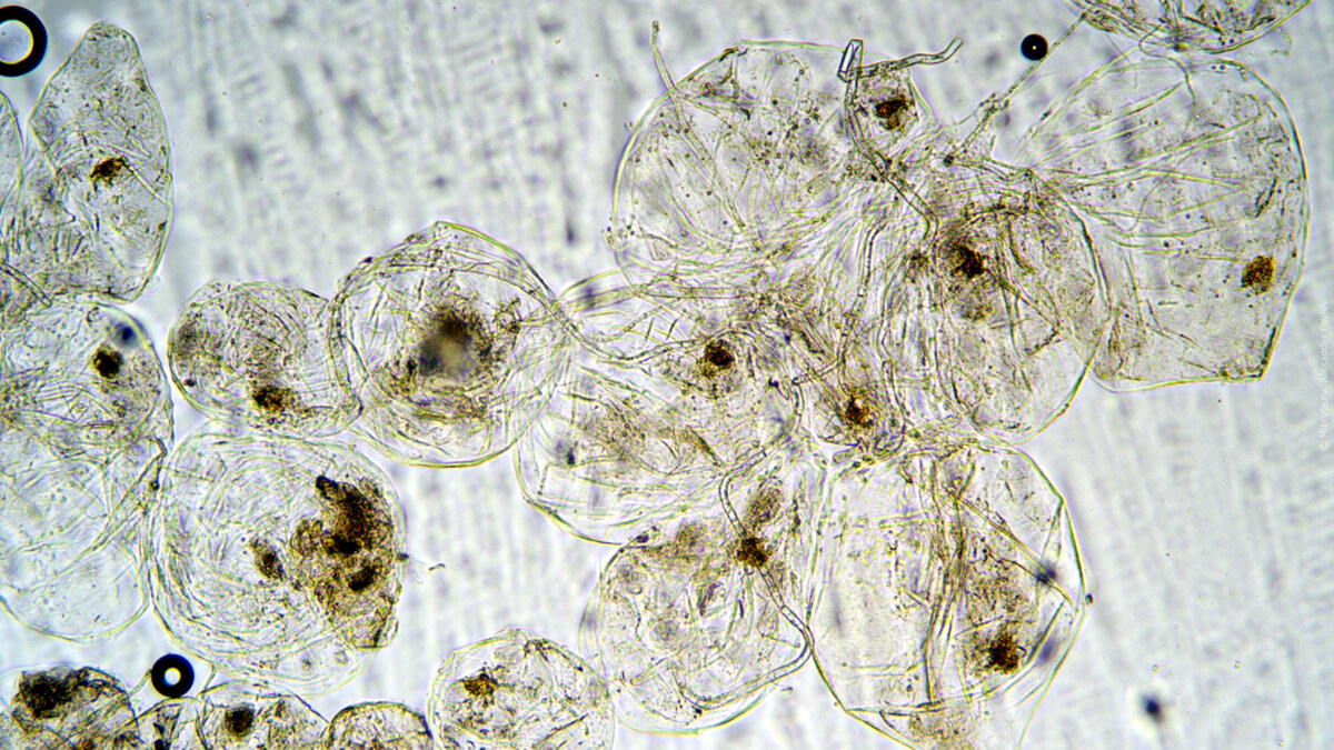 Микро тезе. Пенициллин микроскопия. Мякоть яблока под микроскопом. 1 Мкм под микроскопом. I8048 под микроскопом.
