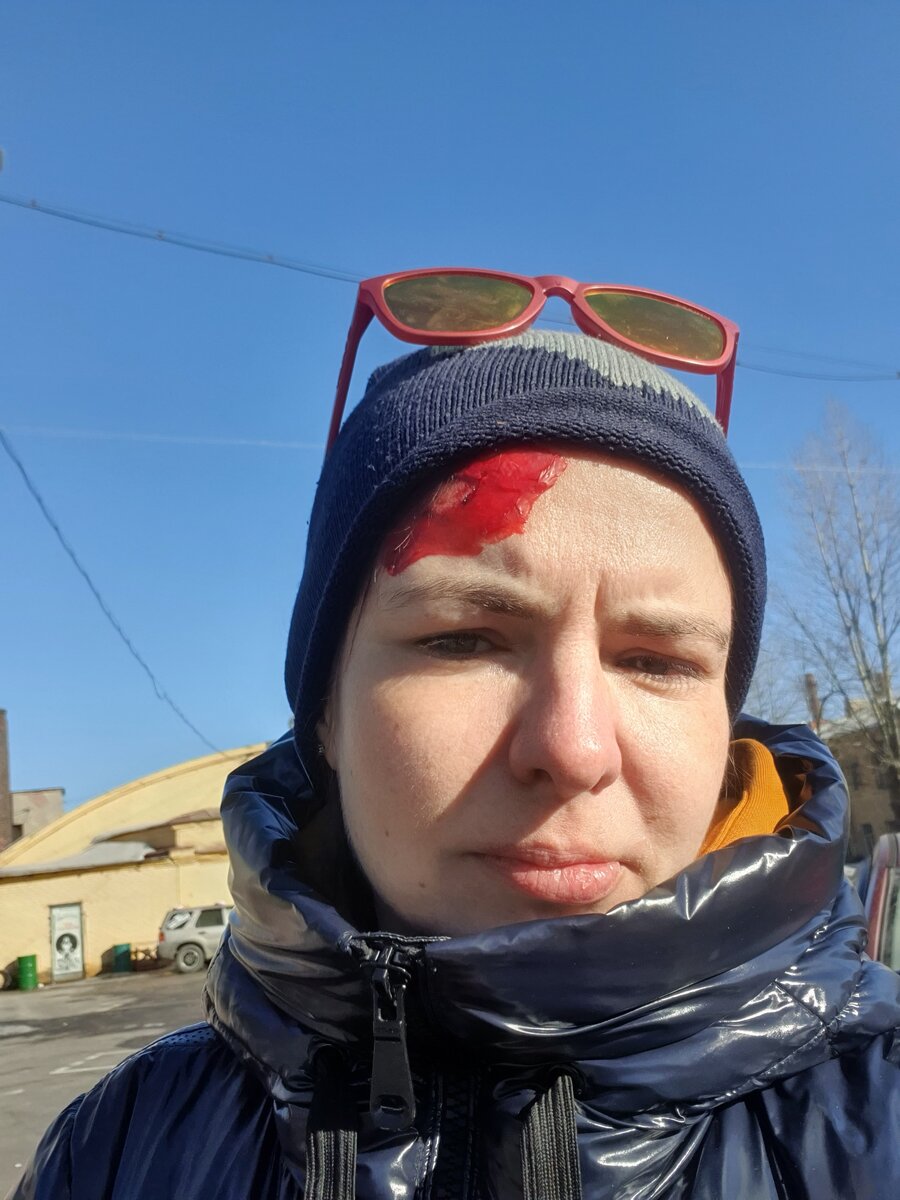 Это грим с тренировки по оказанию помощи при ДТП.