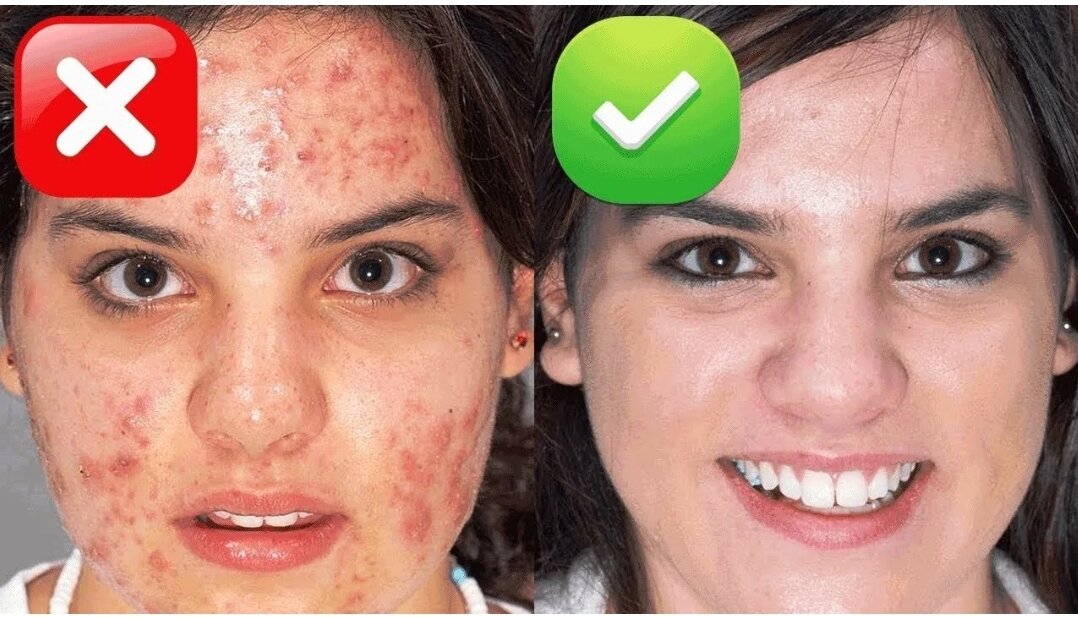 Яндекс-картинки