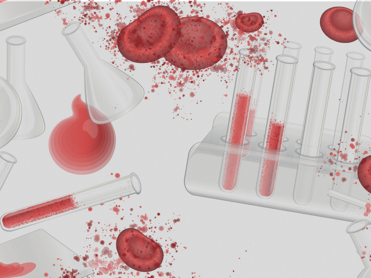 Исследование крови. Лабораторные исследования крови. Лаборатория крови. Исследование крови в лаборатории.
