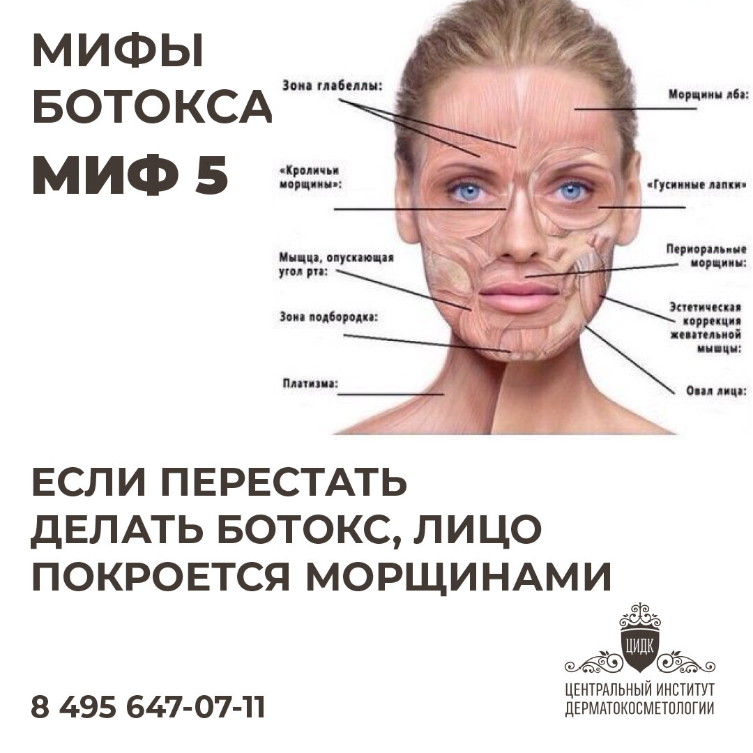 ботокс на следующий день