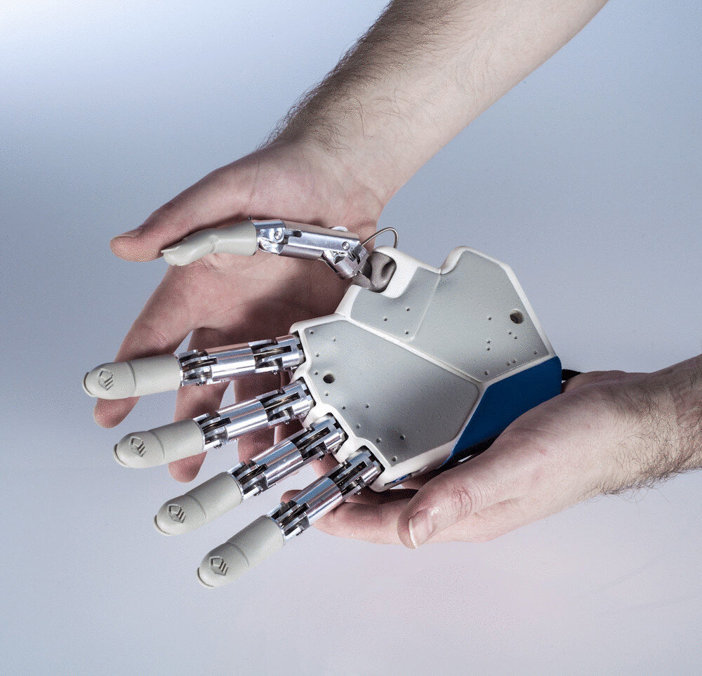Новые технологии протезирования. Touch Bionics протезы. Протез руки Bionic. Бионическая рука ILIMB. Maxbionic протезы.