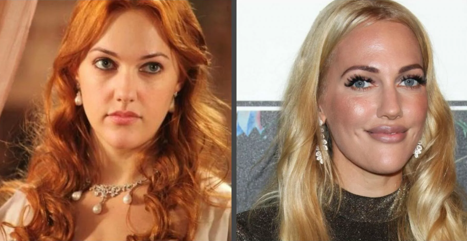 Актриса, Сериалы, Пластика, Преображения