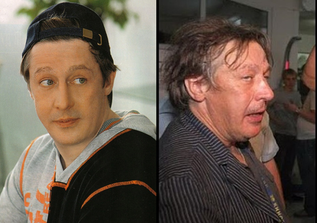 Последствия от  алкоголя на лицо 