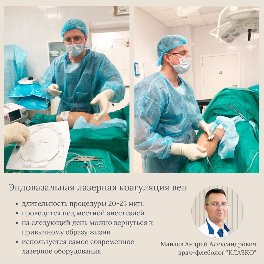 Пациенту была рекомендовано проведение ЭВЛК, которая имеет следующие преимущества: 🔸процедура проводится на современном лазерном оборудовании под местной анестезией;
🔸длительность операции не превышает 25 мин❗;
🔸реабилитационный период минимален, уже на следующий день можно вернуться к привычному образу жизни, исключив сильные физические нагрузки.
⠀
Стоимость в КЛАЗКО от 76 500 руб.