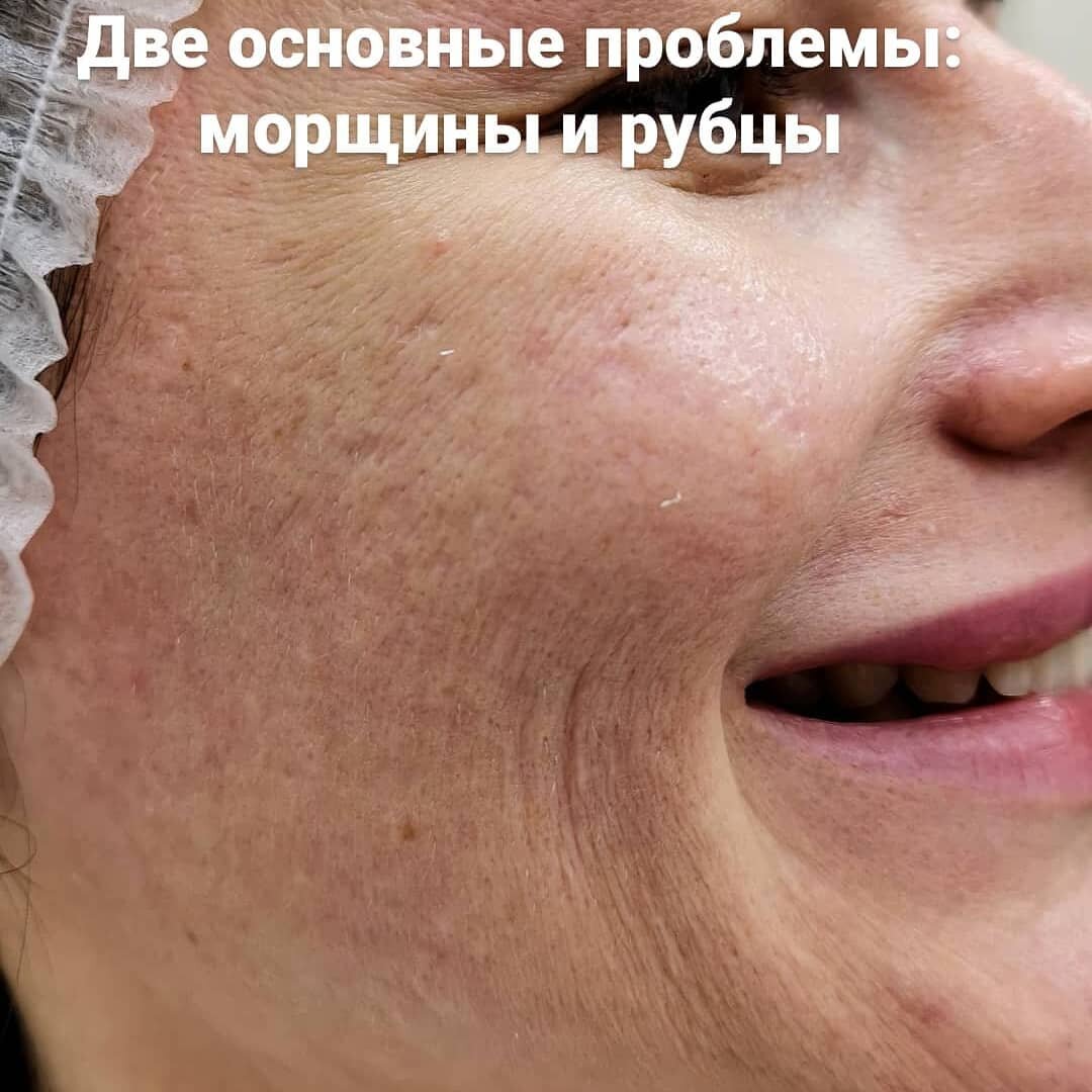 Кожа вблизи