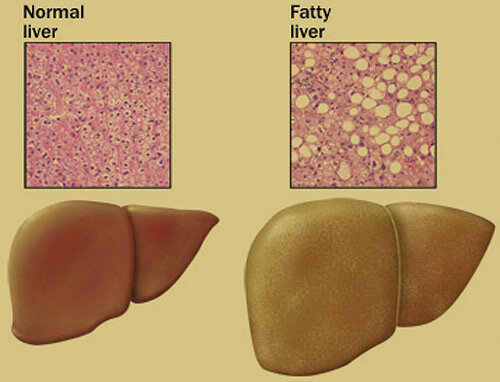 Would An Enlarged Liver Cause Your Right Breast To Shrink Discount xn--h1aahyg1d