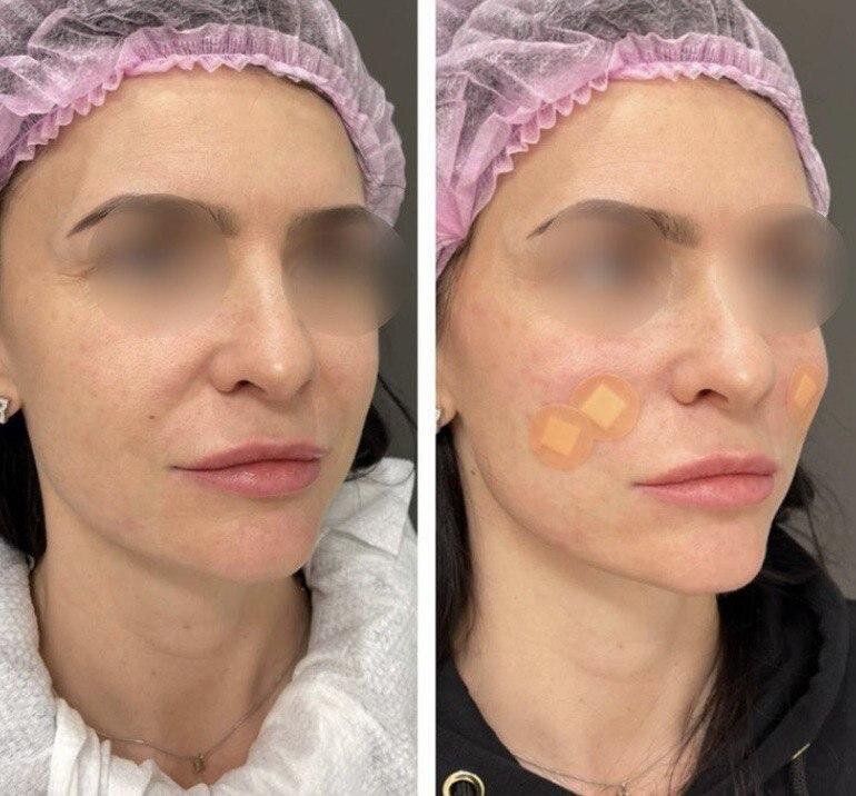 Клиника эстетической медицины и косметологии FaceLifting Москва