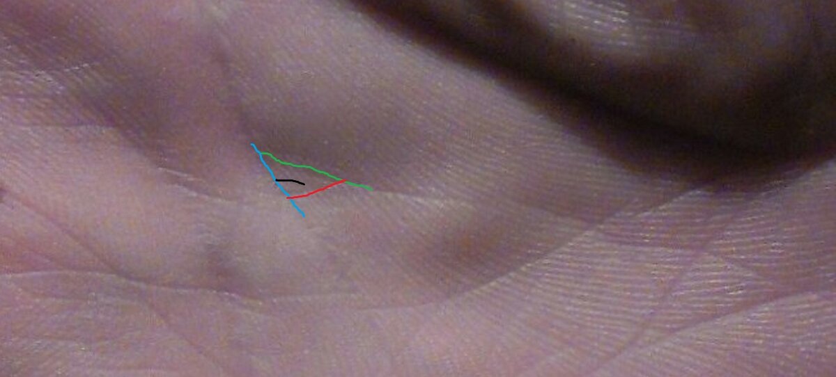 Треугольник денежного кошелька образован фрагментами линий ума (голубая), судьбы (зелёная) и нижней секущей, образующей дно кошелька (красная). Знак чужой руки в кошельке - черная наклонная линия внутри треугольника знака кошелька. Фото из личного архива.