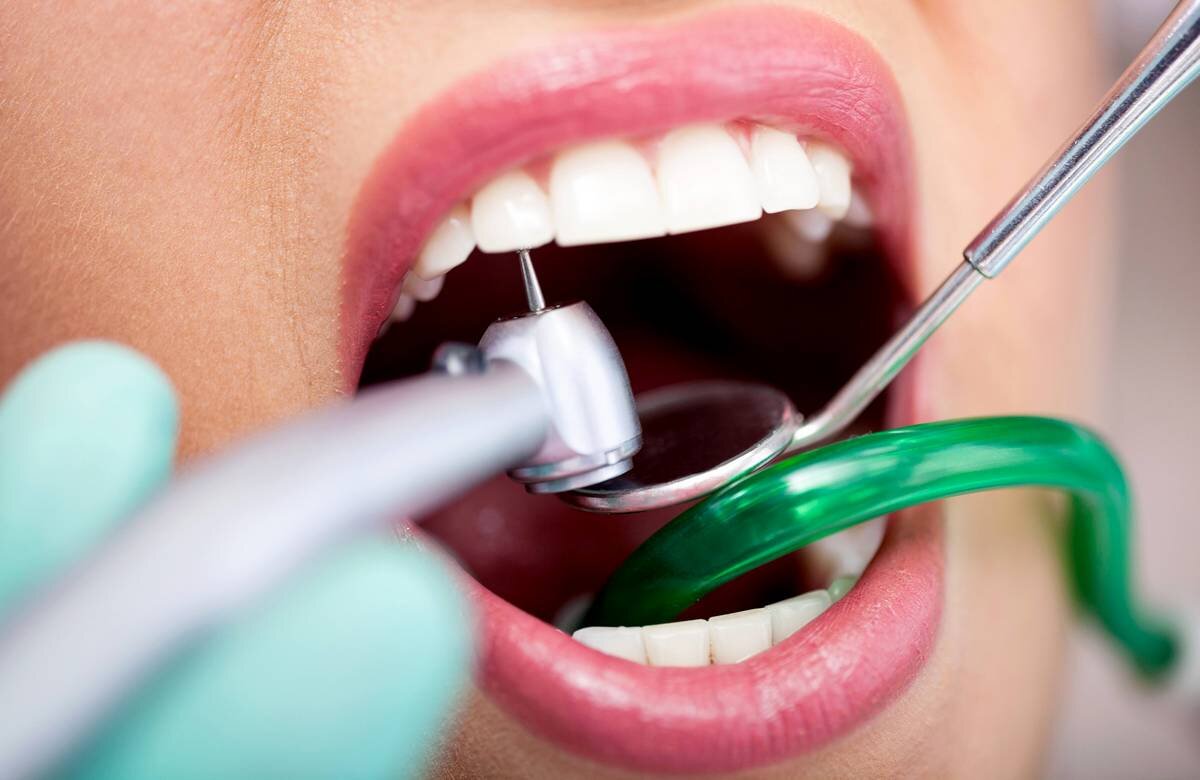 Терапия стоматология. Профилактика кариеса и заболеваний полости рта.