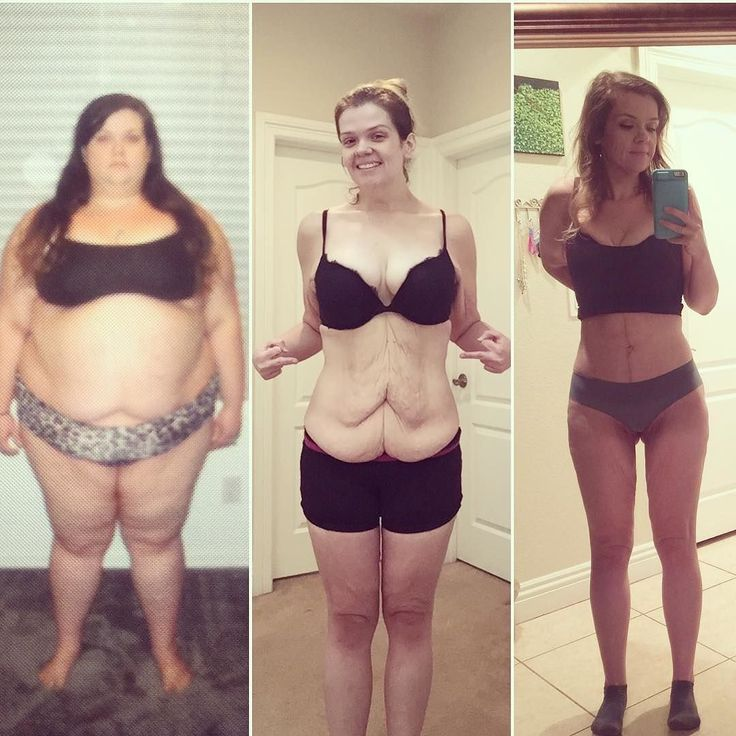 Изменения после 30. Похудение до и после. Iuдо и после похудения. Полные девушки до и после. Вес до и после похудения.