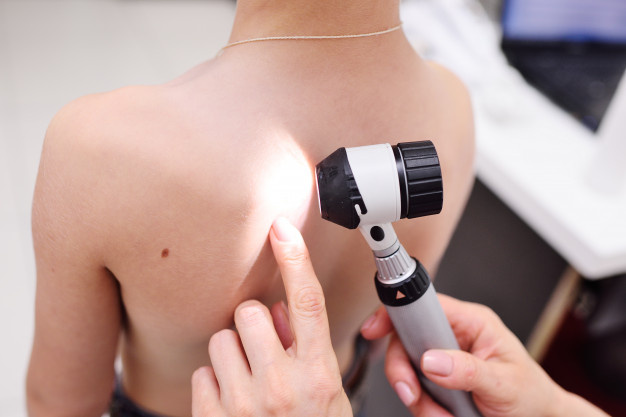 Независимо от вида рака кожи: базальноклеточная карцинома, плоскоклеточная карцинома, меланома, симптомами являются изменения участков кожи.