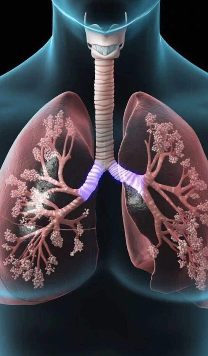 Легкие здорового человека 