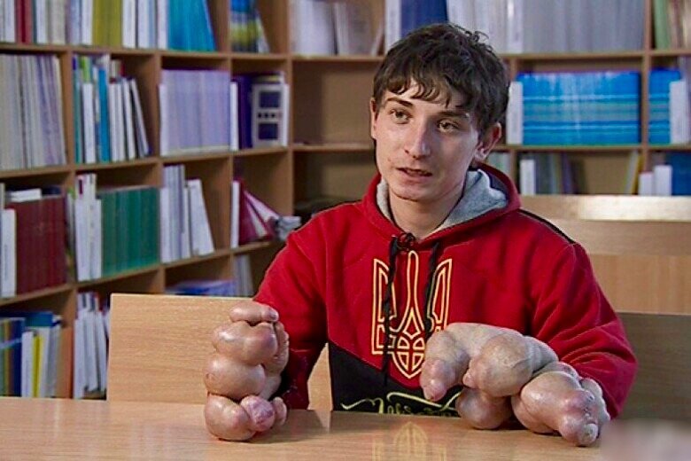 Как сложилась жизнь Ивана Павлюка после участия в проекте "Я стесняюсь своего те