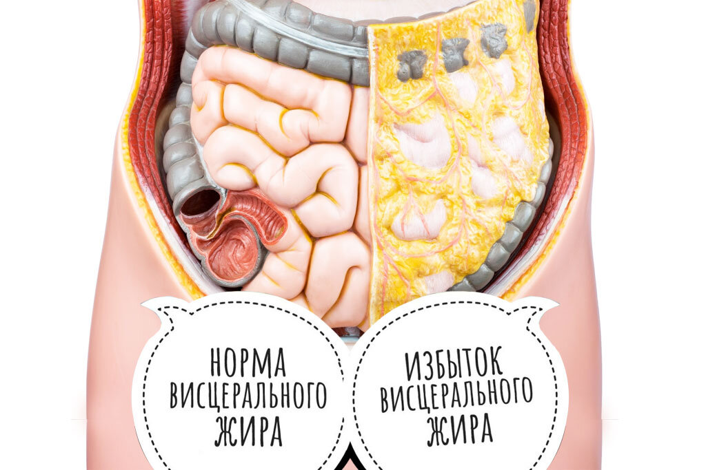 Висцеральный жир картинка