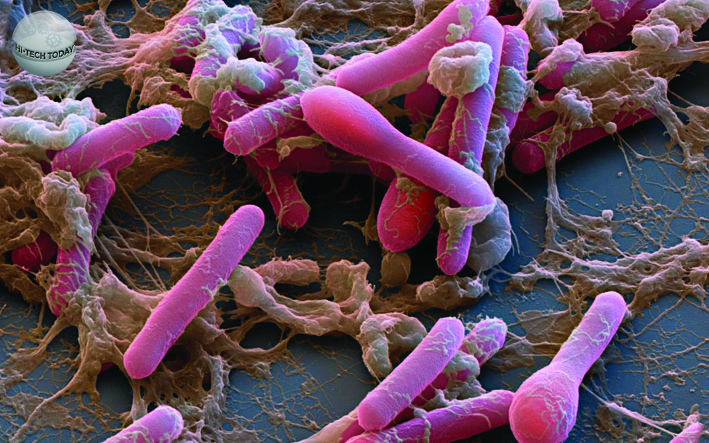 Бактерии возбудители