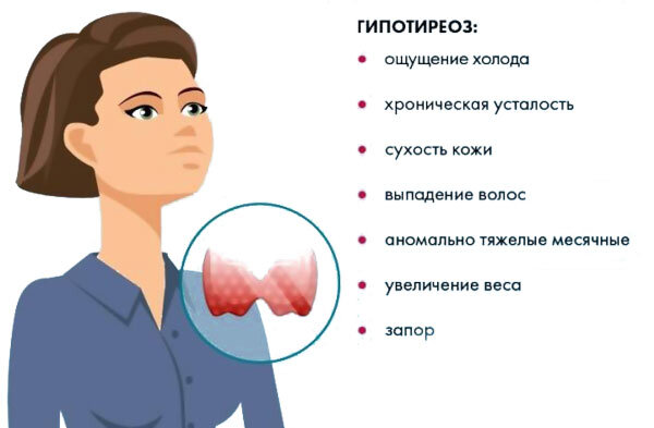 Гипотиреоз – заболевание, связанное с нарушением в работе щитовидной железы, которое появляется на фоне недостатка йода. Лечение данного типа патологии предполагает не только использование лекарственных средств, но и диетическое питание, так как на фоне болезни замедляются обменные процессы.