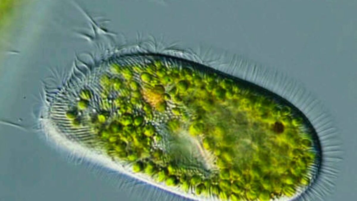 Paramecium tetraurelia