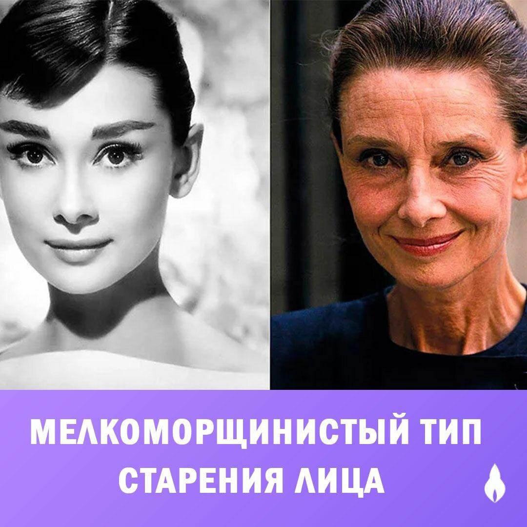 Уставший тип лица. Сандра Буллок морфотип старения. Деформационный Тип старения Катрин Денев. Мелкоморщинистый Тип старения.