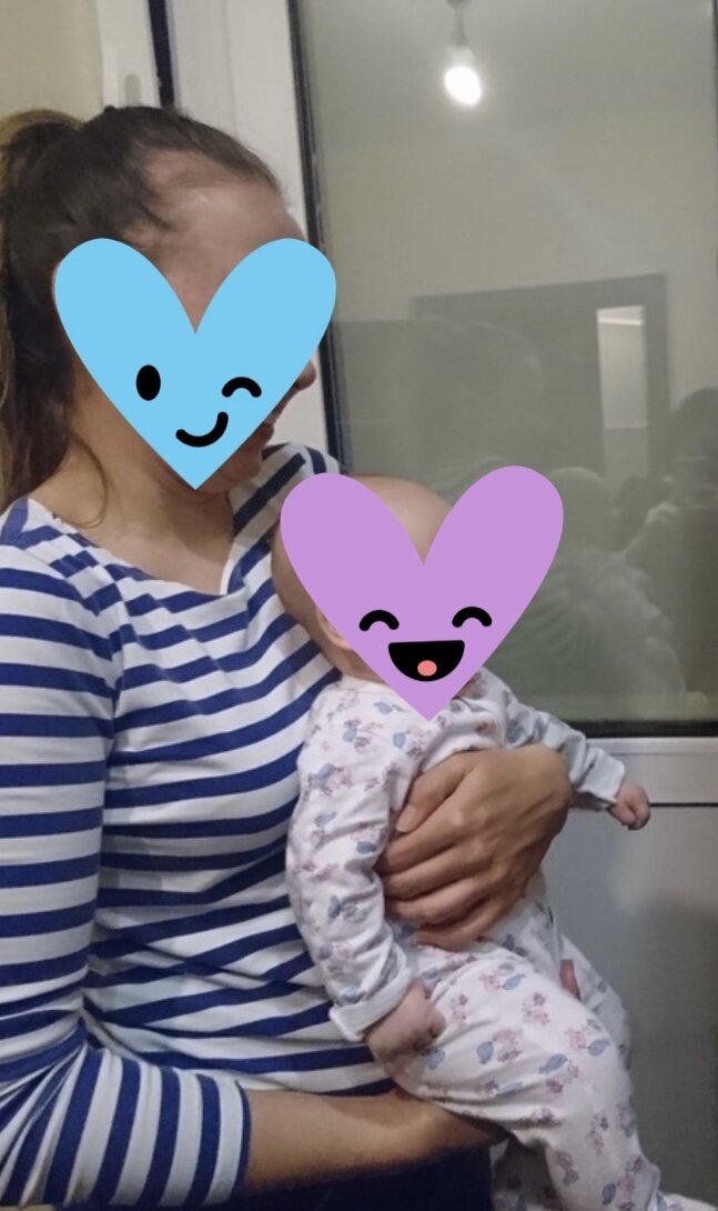 Вот здесь залысины хорошо видно 