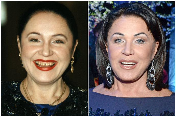 Надежда Бабкаина до и после. Источник: Yandex.картинки