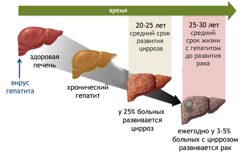 Все о лечении гепатита: интервью с руководителем клиники МедЭлит Михаилом Юрьевичем Галушко