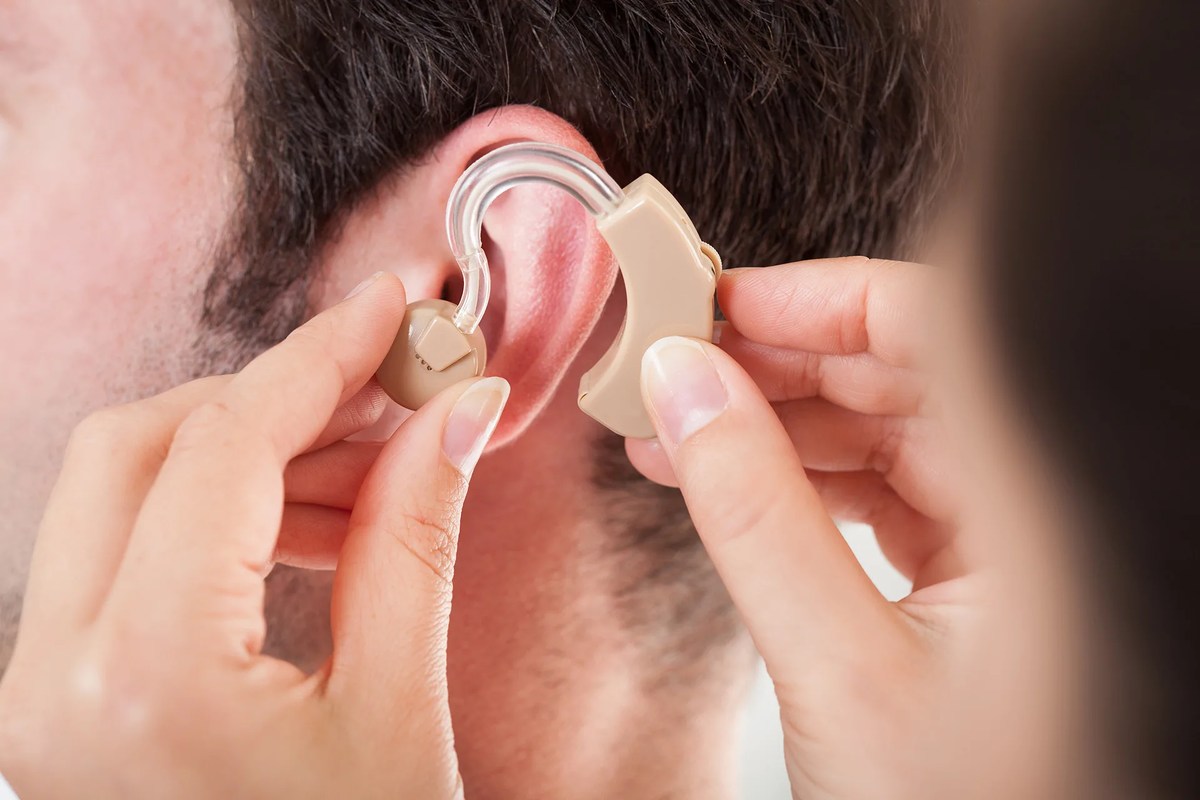 Пациенты с нарушением слуха. Слуховой аппарат тугоухость 4. Аппарат для глухих кохлеарная имплантация. Слуховой аппарат Cochlear 8. Ушной аппарат глуховатого человека.