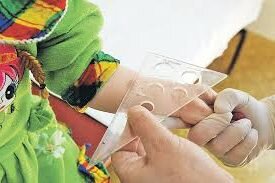 Идея о том, что прививку нельзя мочить появилась в сознании людей давным-давно: когда для выявления туберкулеза у населения применяли пробу Пирке. Механизм её действия мало отличался от того, по которому работает проба Манту, но одно отличие было ключевым: для пробы Пирке проводится неглубокий разрез на коже, после чего на него наносят туберкулин.