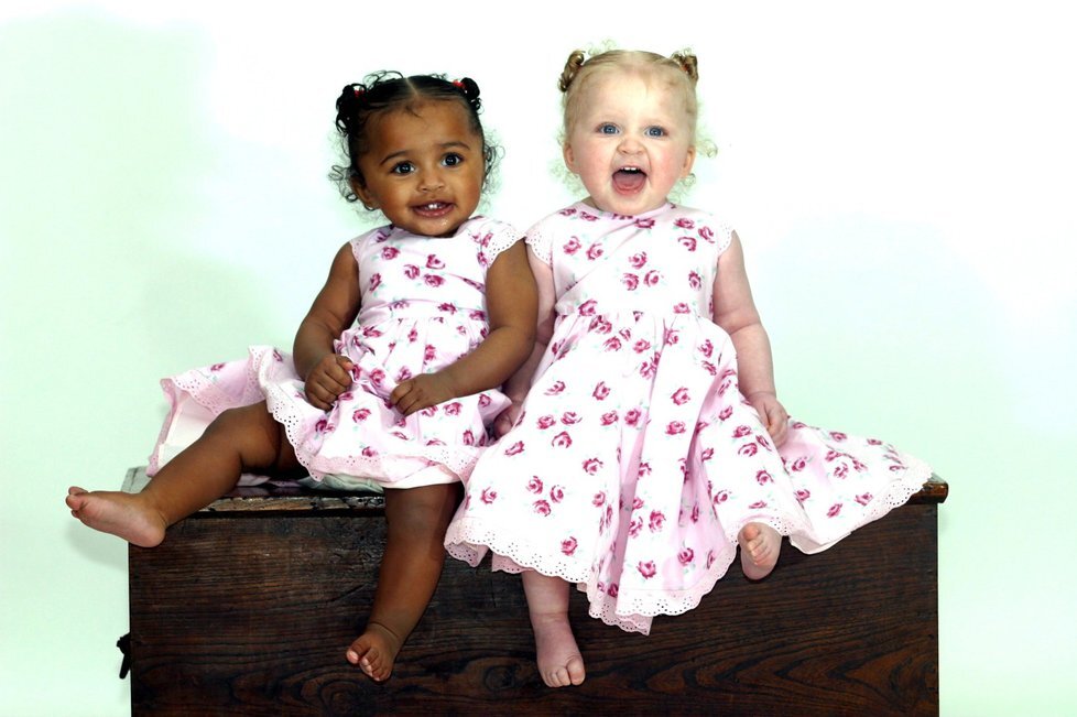 Две черные близняшки. Сёстры Киан и Реми Хордер. Близнецы девочки. Разноцветные двойняшки. Близнецы белая и черная девочки.