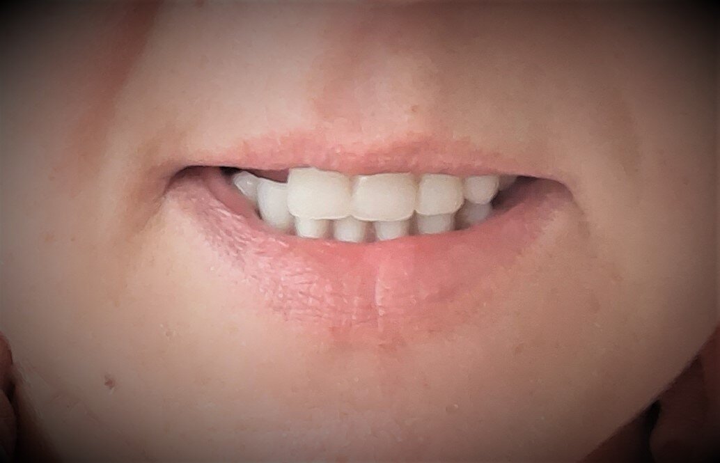 Утренний сюрприз "от зубов с любовью"