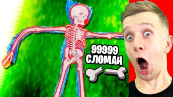 *Omg*  СЛОМАЛ КОСТИ ХАГГИ ВАГГИ !!!