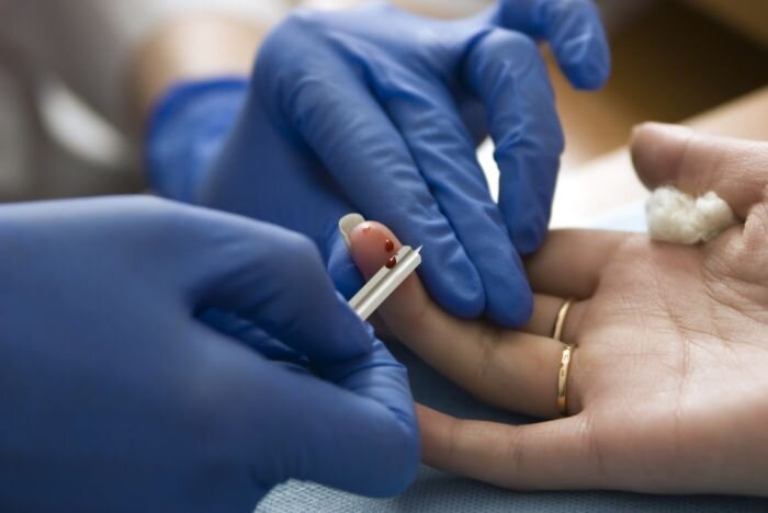 Кровь на сахар можно сдать из пальца и из вены, в первую очередь - натощак