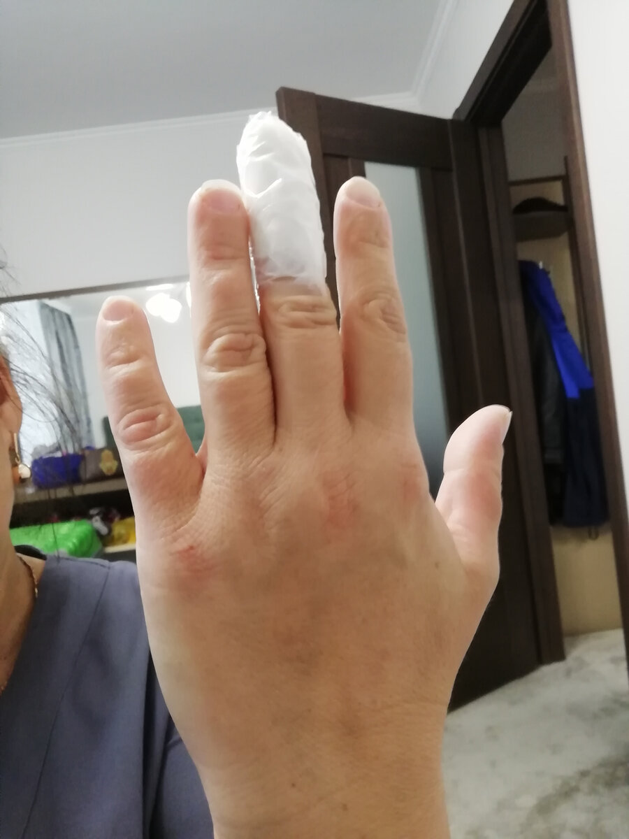 Округлые ногти на руке. Фото из личного архива.