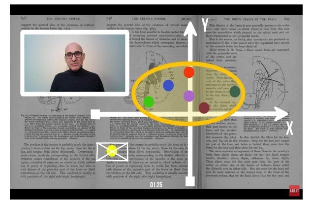 Рисунок. 8. Скриншот из блиц-лекции «Площадь статокинезиограммы»