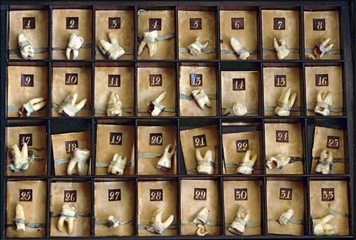 Зубы,вырванные Петром Великим