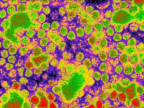 Микроскопия и компьютерная визуализация.