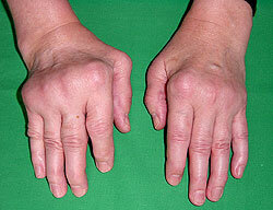 Фото  http://medac.ua