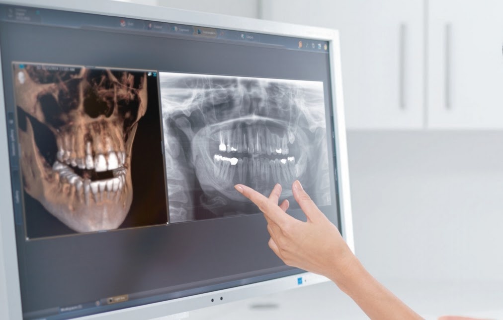 Компьютерное 3D-моделирование