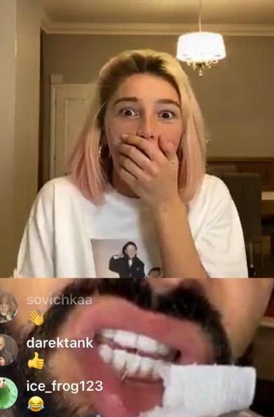 Тимати проколол губу