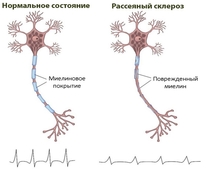 Картинка: beremennuyu.ru