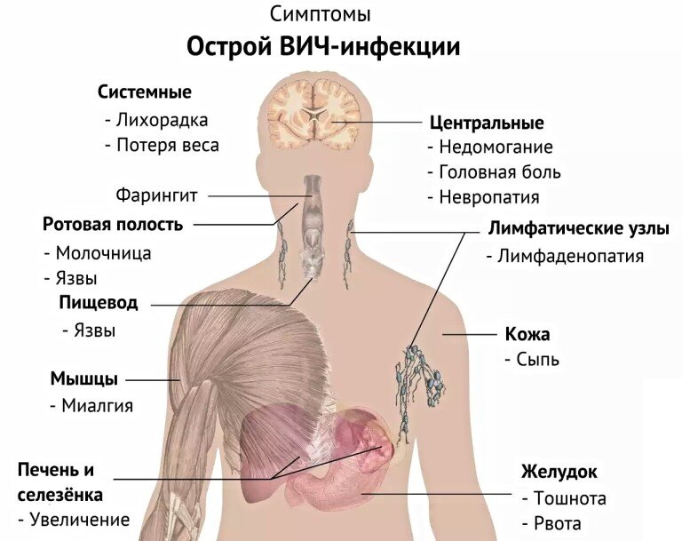 Симптомы ВИЧ-инфекции у женщин — Признаки заражения ВИЧ