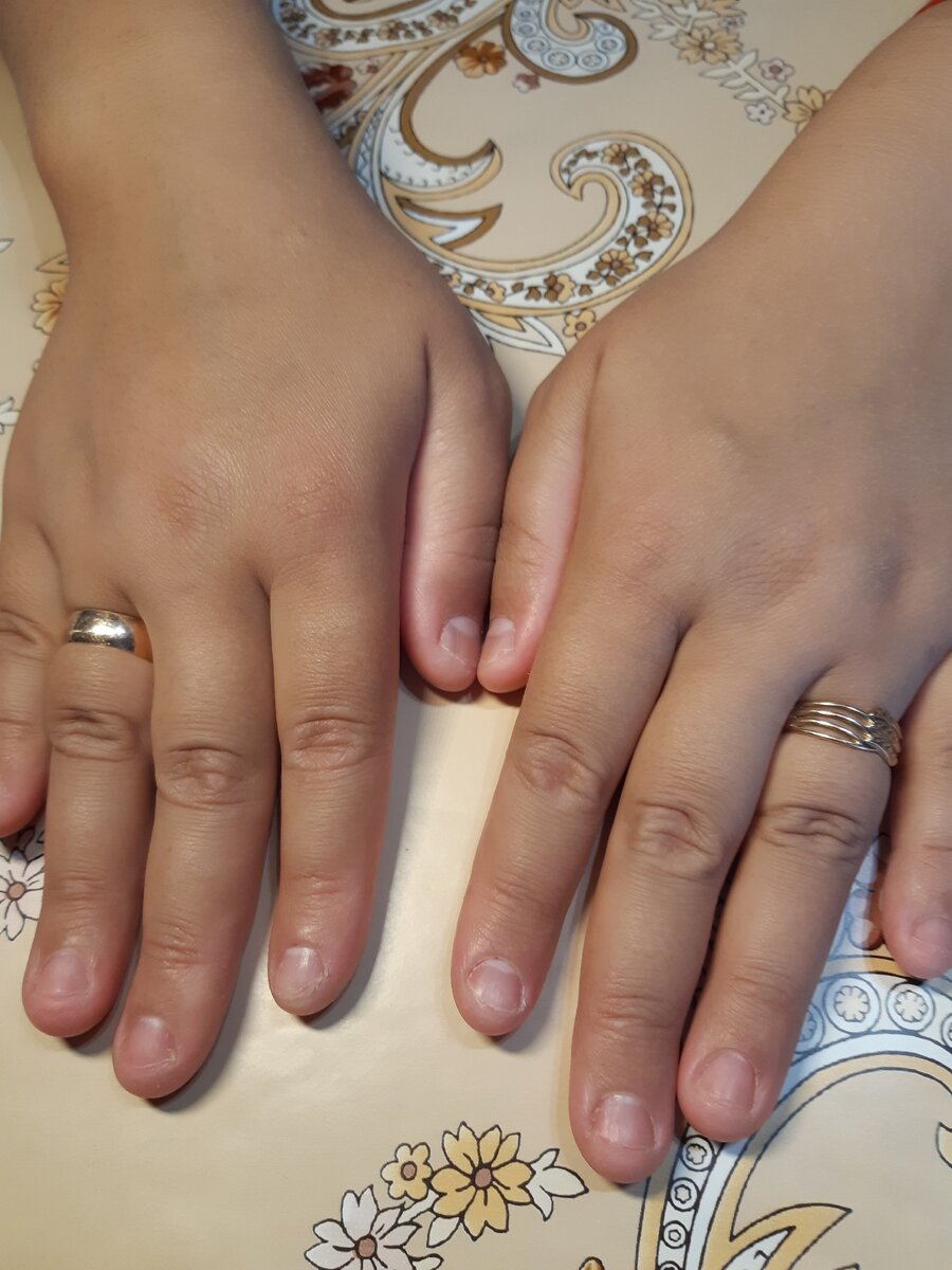 Пальчики грызуны