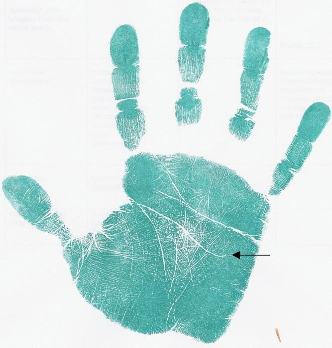 Ложка миллионера на уонце линии ума (головы). https://liniya-jizni.livejournal.com/13960.html