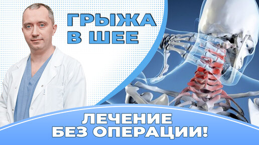 Упражнения при грыжах и протрузиях в шейном отделе позвоночника. | Центр Дикуля