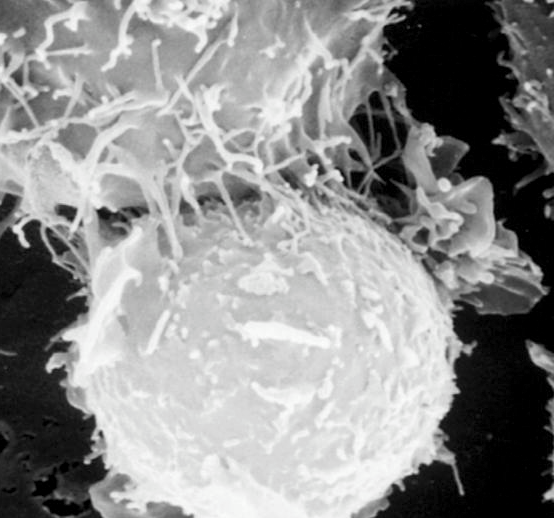 Т-киллер, атакует раковую клетку